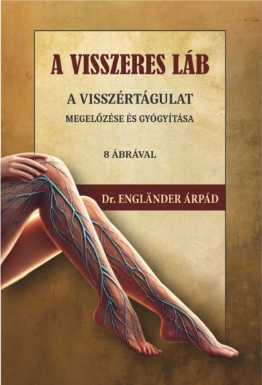 A visszeres láb a visszértágulat megelőzése és gyógyítása